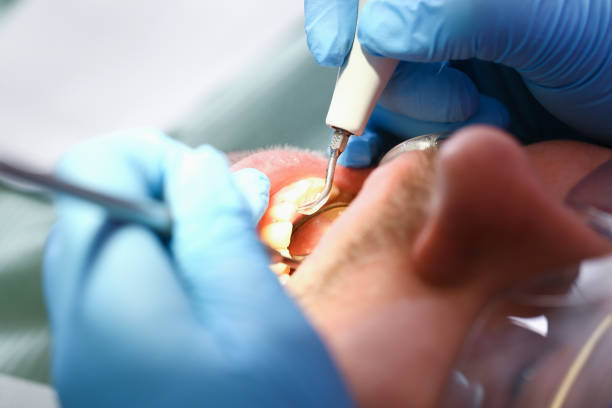 Best Emergency TMJ Treatment in Greenhills, OH