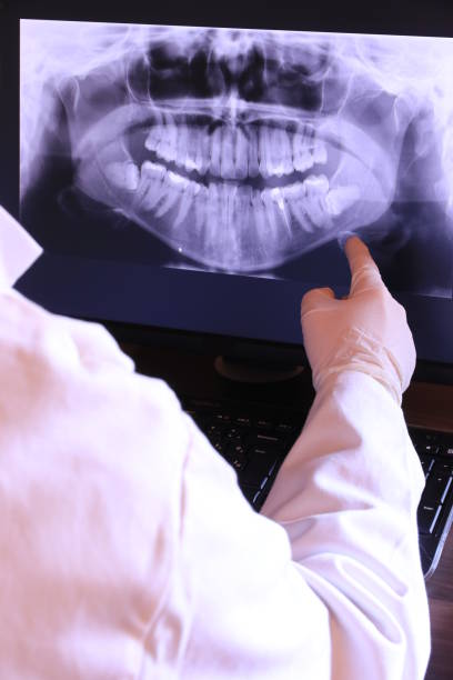 Best Emergency Treatment for Dental Infections or Abscesses in Greenhills, OH